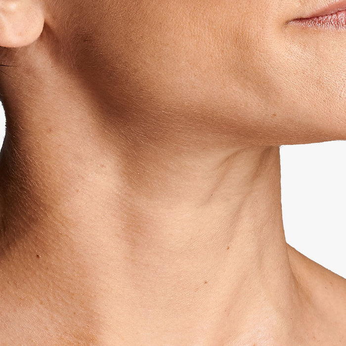 why does neck skin sag?